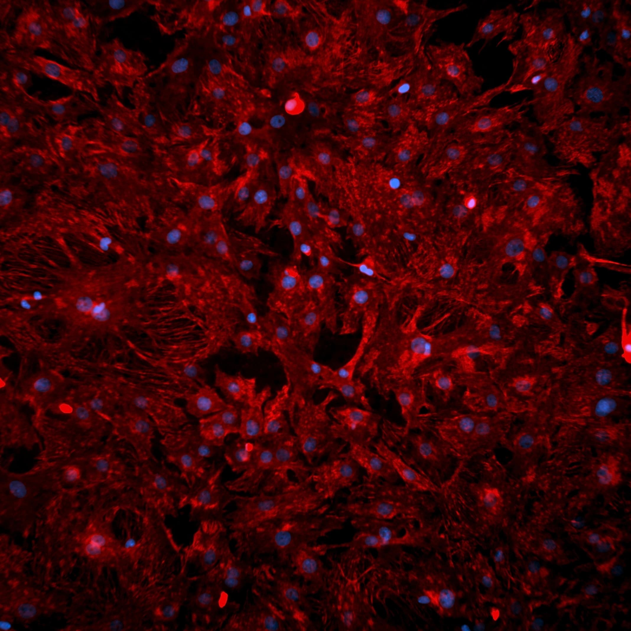 Cardio fibroblasts were stained with Vimentin - image 1