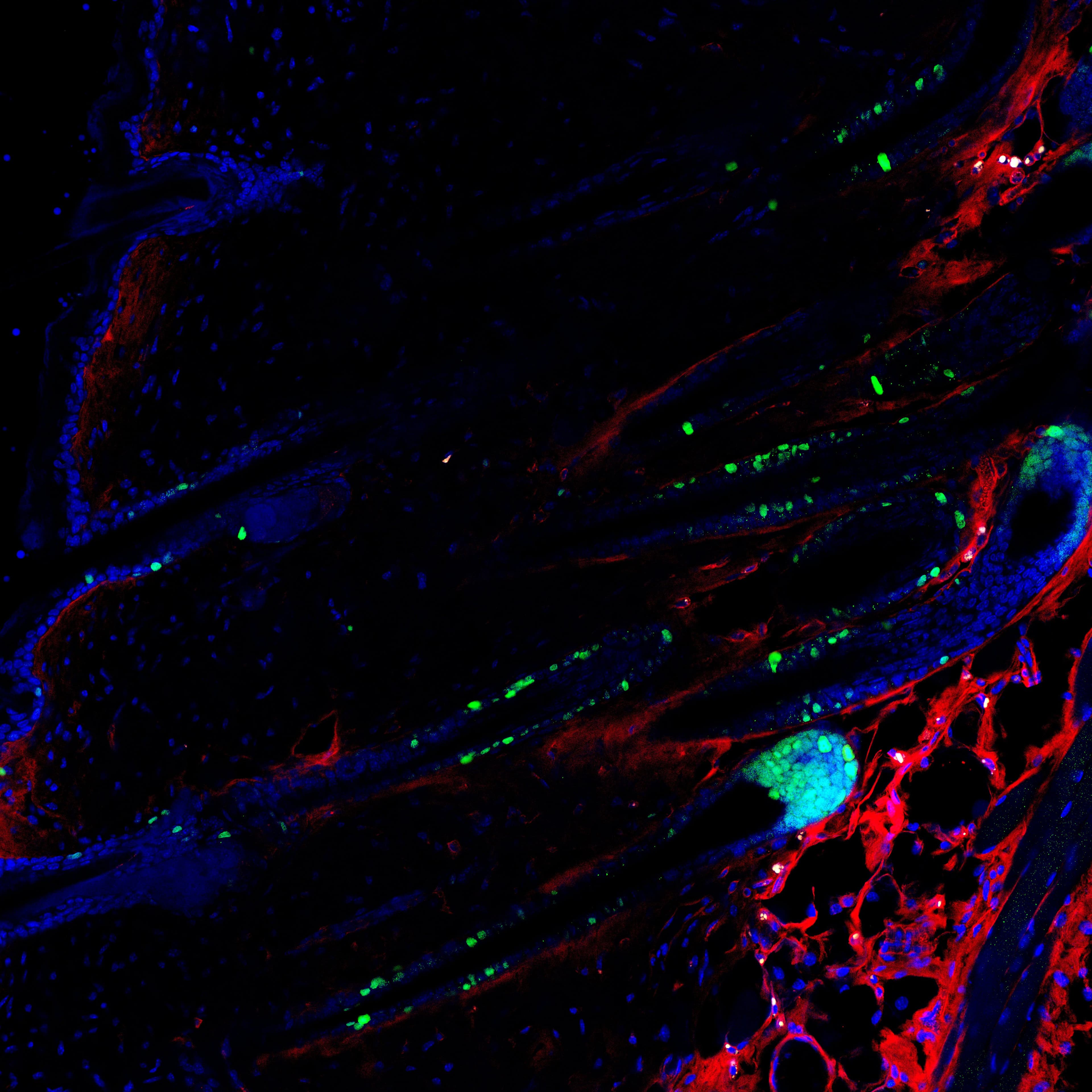 Hair Follicles were stained with Ki67 and K14 - image 1
